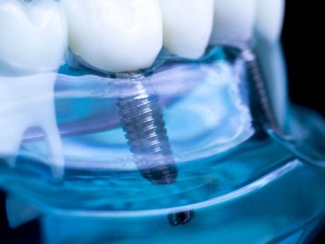 {{brizy_dc_image_alt entityId=